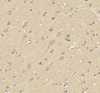 IHC staining of FFPE human brain tissue with SKP1 antibody. HIER: boil tissue sections in pH8 EDTA b