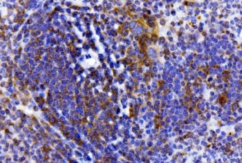IHC staining of FFPE mouse spleen tissue with IL-2 receptor alpha antibody. HIER: boil tissue sectio