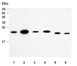 Monocyte Chemotactic Protein 2 Antibody / MCP2 / CCL8