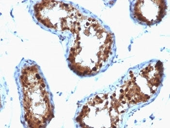 IHC: Formalin-fixed, paraffin-embedded human testicular carcinoma stained with SUMO-2/3 antibody (cl