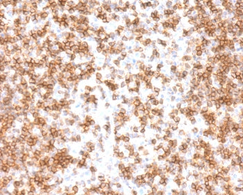 IHC staining of FFPE human tonsil tissue with recombinant CD45 antibody (clone CDLA45-3R). Required 