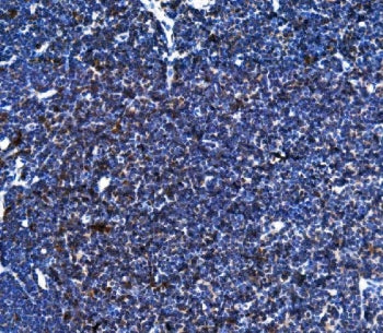 Cxcr5 Antibody / Blr1 / Mdr15
