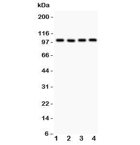 Western blot testing of TRPC7 antibody and Lane 1: mouse brain; 2: human A549; 3: (h) COLO320; 4: (h