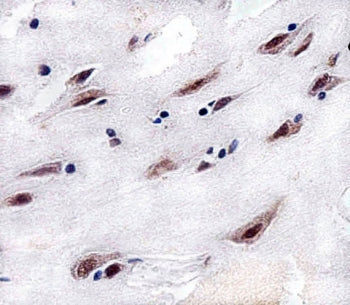 IHC testing of FFPE human brain tissue with CSNK2A1 antibody. HIER: steam section in pH6 citrate buf