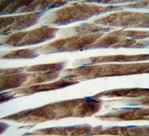IHC testing of FFPE human skeletal muscle tissue with ILKAP antibody. HIER: steam section in pH6 cit
