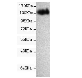 Western blot testing of human CaCo2 cell lysate with CD133 antibody at 1:1000. Predicted molecular w