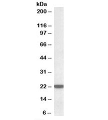 Western blot testing of human liver lysate with LMP7 antibody at 0.01ug/ml. Predicted molecular weig
