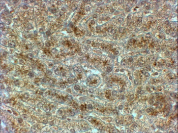 IHC testing of FFPE human liver with SYVN1 antibody at 2ug/ml. HIER: steamed with pH6 citrate buffer