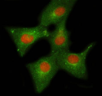 Immunofluorescent staining of FFPE human A549 cells with NELFE antibody (red) and Beta Tubulin mAb (