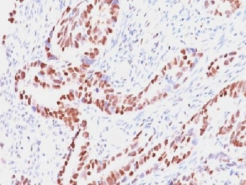 Retinoblastoma Antibody / Rb1