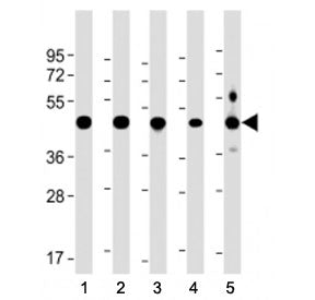 Western blot testing of NSFL1C antibody at 1:2000 + human lysate 1: 293, 2: A431, 3: NCI-H1299, 4: U