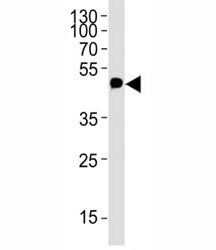 c-Myc Antibody