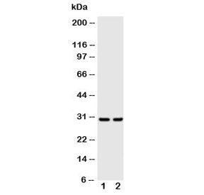 Western blot testing of Kallikrein-1 antibody and Lane 1: rat pancreas lysate; 2: rat kidney lysate.