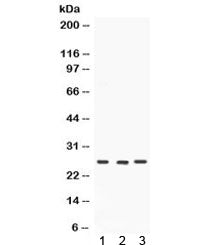 Western blot testing of 1) rat brain, 2) mouse testis and 3) human SW620 lysate with SIP antibody. E