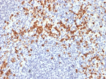 MMP9 Antibody / Matrix metalloproteinase-9