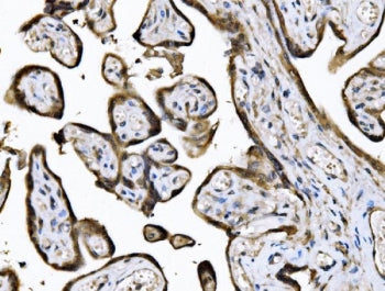 KIF2A Antibody / Kinesin-like protein KIF2A