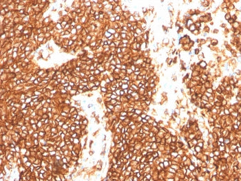 CD99 Antibody / MIC2