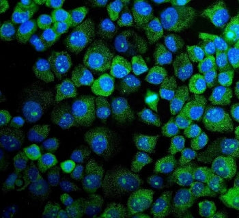 Immunofluorescent staining of FFPE human A431 cells with MAPK11 antibody (green) and DAPI nuclear st