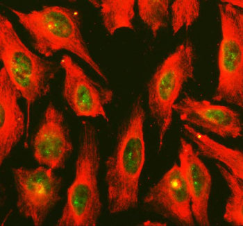 Immunofluorescent staining of FFPE human U-2 OS cells with IRF8 antibody (green) and Alpha Tubulin m