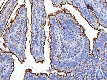 MGAM Antibody / Maltase-glucoamylase