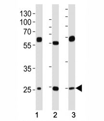 Western blot analysis of lysate from (1) HeLa, (2) HepG2 and (3) U-2OS cell line using TFAM antibody