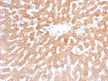 SDHB Antibody / Succinate dehydrogenase B