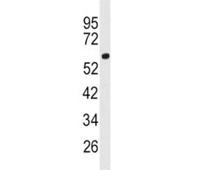 ACSL3 Antibody / FACL3