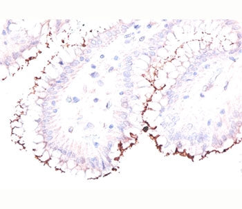 Helicobacter Pylori Antibody