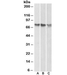 Western blot of human A) HepG2, B) K562 and C) HeLa cell lysate (nuclear fractions) with ATF2 antibo