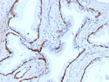 IHC staining of FFPE human prostate tissue with recombinant Keratin 14 antibody (clone KRT14/7977R).