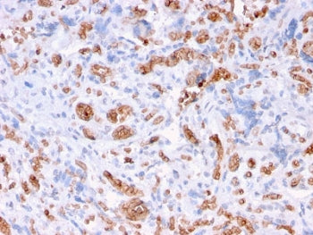 IHC staining of FFPE human placenta with Spectrin alpha 1 antibody (clone rSPTA1/1832). Required HIE