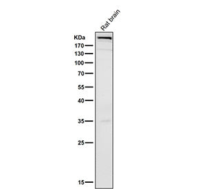 Rat brain tissue lysate tested with the MTOR antibody at 1:500 dilution for 1 hour at room temperatu