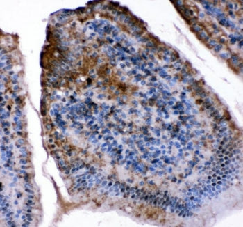 FABP5 Antibody