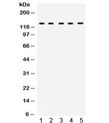 TRPM8 Antibody