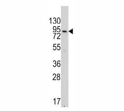 Western blot analysis of VE Cadherin antibody and 293 lysate. Expected molecular weight: 90~140 kDa 
