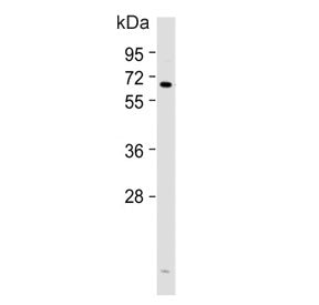 Western blot testing of human HACAT cell lysate with Cyclooxygenase 2 antibody. Predicted molecular 