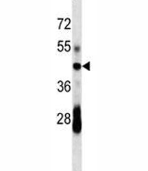CD79a antibody western blot analysis in mouse spleen tissue lysate. Predicted/Observed molecular wei