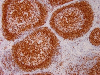 PAX5 Antibody