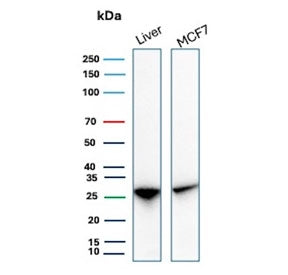 Western blot testing of human liver and MCF7 cell lysate with HSP27 / HSPB1 antibody (clone rHSPB1/7