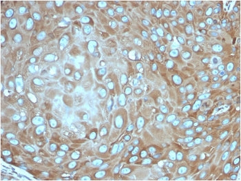 RPSA Antibody / 40S Ribosomal protein SA