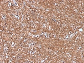 IHC testing of FFPE human cerebellum with NSE antibody (clone ENO2/1375). Required HIER: boil sectio