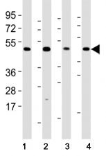 Western blot testing of Mlkl antibody at 1:2000 dilution and mouse samples: (1) lung, (2) NIH3T3, (3