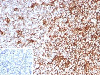 IHC staining of FFPE human tonsil tissue with recombinant CD63 antibody (clone LAMP3/8799R). Inset: 