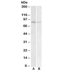 Western blot testing of human peripheral blood lymphocyte [A] and human spleen [B] lysate with BACH1