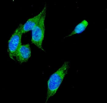 Alcohol dehydrogenase Antibody / ADH1A