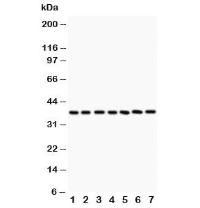 Western blot testing of LIF antibody and Lane 1: rat intestine; 2: (r) brain; 3: (r) spleen; 4: (r) 