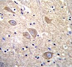 IHC testing of FFPE human brain tissue with VSNL1 antibody. HIER: steam section in pH6 citrate buffe