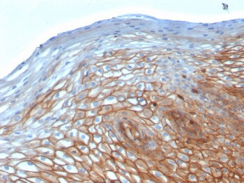 IHC staining of FFPE human cervix with Drebrin 1 antibody (clone DBN1/2880). HIER: boil tissue secti