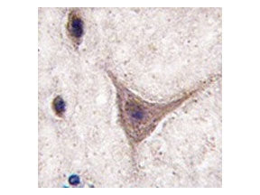 IHC testing of FFPE human brain tissue with Cadherin 10 antibody. HIER: steam section in pH6 citrate