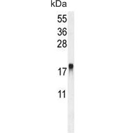 ARL8A Antibody